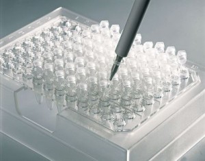 Фото процесса ДНК-диагностики ВПЧ