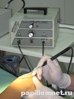 Фото радиохирургии