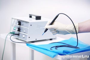 Изображение лазера для удаления новообразований