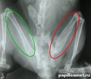 Костная мозоль на рентгеновском снимке