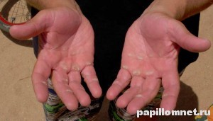 Фото ладоней с мозолями