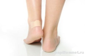 Своевременное лечение - залог быстрого заживления мозоли