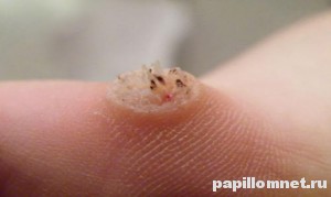 Изображение шипицы на руке человека