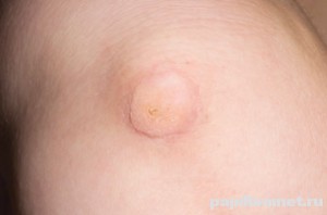 Фото куриной попки на ноге