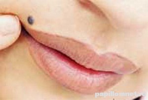 Фото родинки на лице