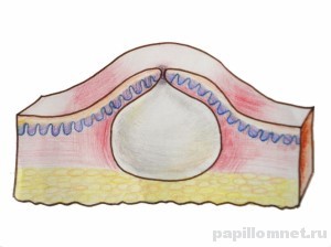 Фото схемы расположения атеромы на коже головы Фото схемы расположения атеромы на коже головы