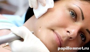 Фото девушки на процедуре удаления родинки 