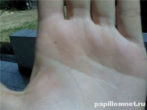 Фото родинки на ладони