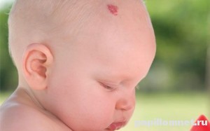 Фото новорожденного с родинкой на голове