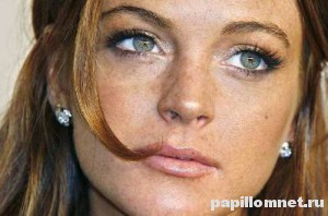 Знаменитость с пигментными пятнами на лице