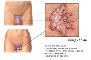 Локализация заболевания Локализация заболевания
